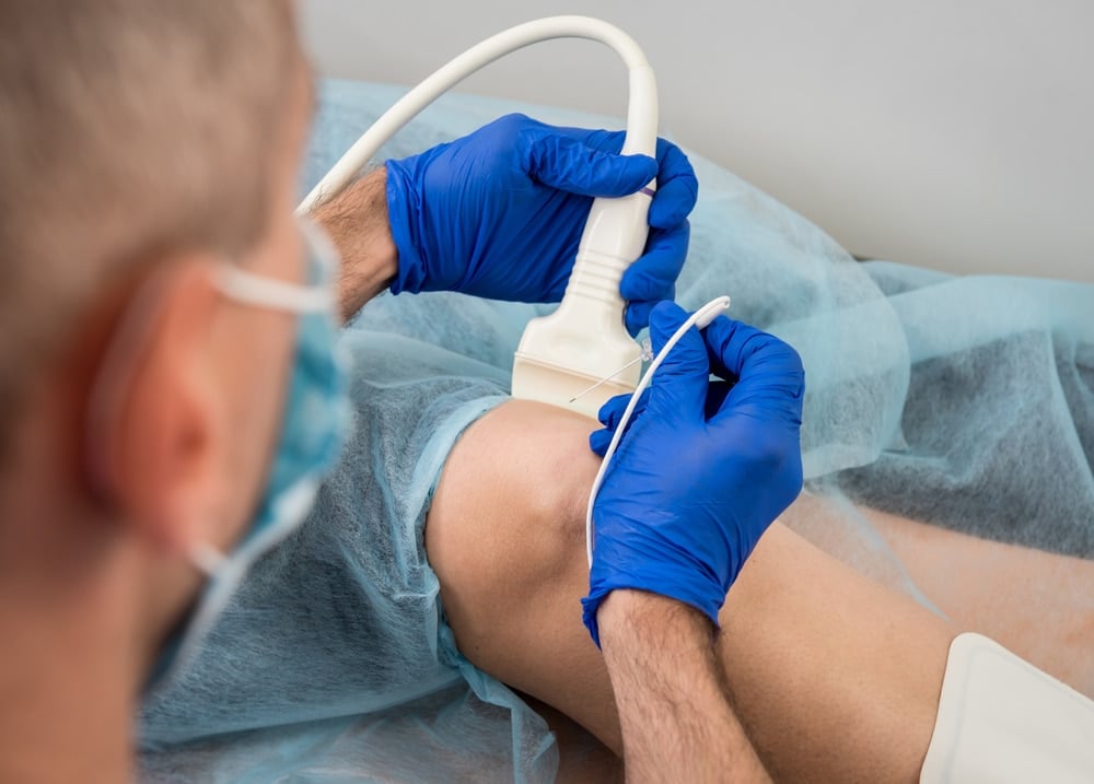 What To Expect with This Pain Management Procedure