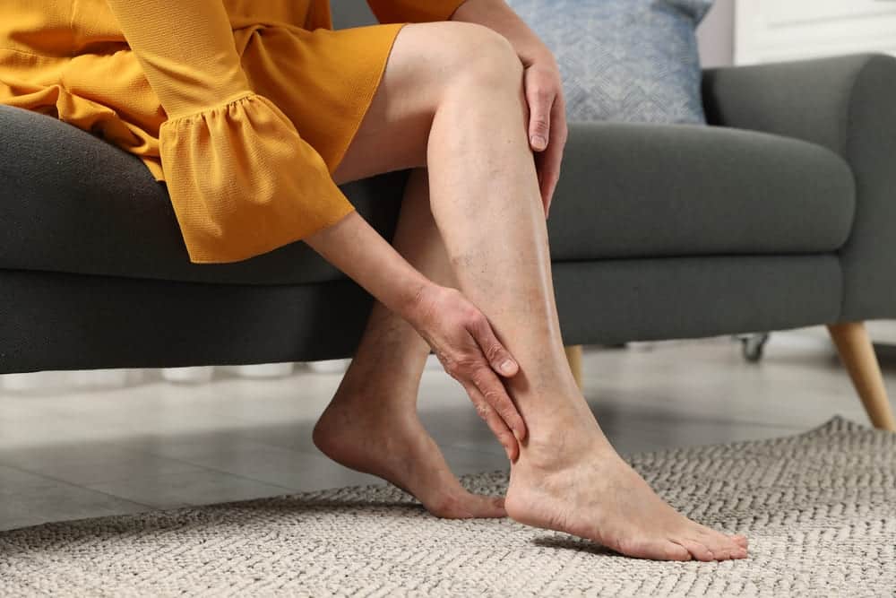 Varicose Veins Treatment