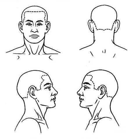 Pain Diagram Head and Side Views