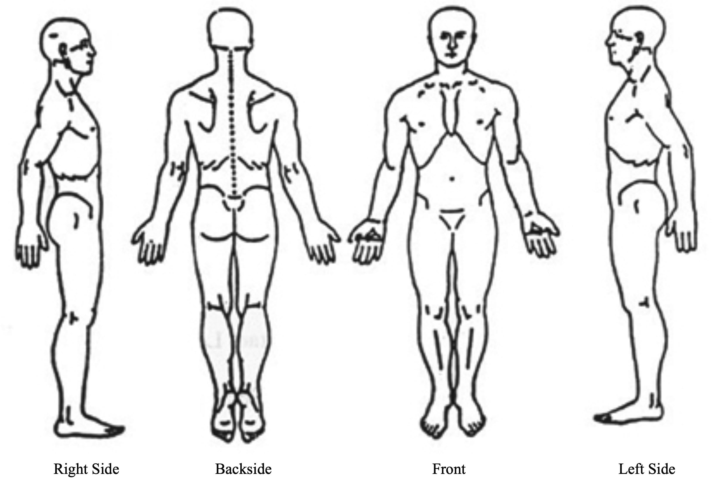 Pain Diagram - Full Body Views